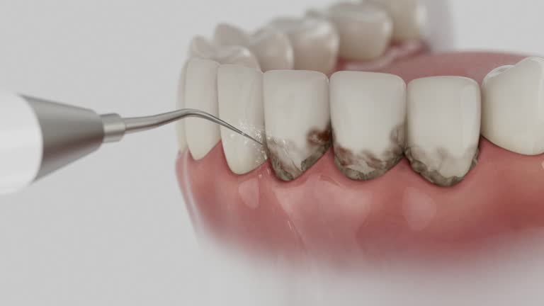 Reliable Tooth Extraction contractor in Florin, CA by Smile Center Dentistry
